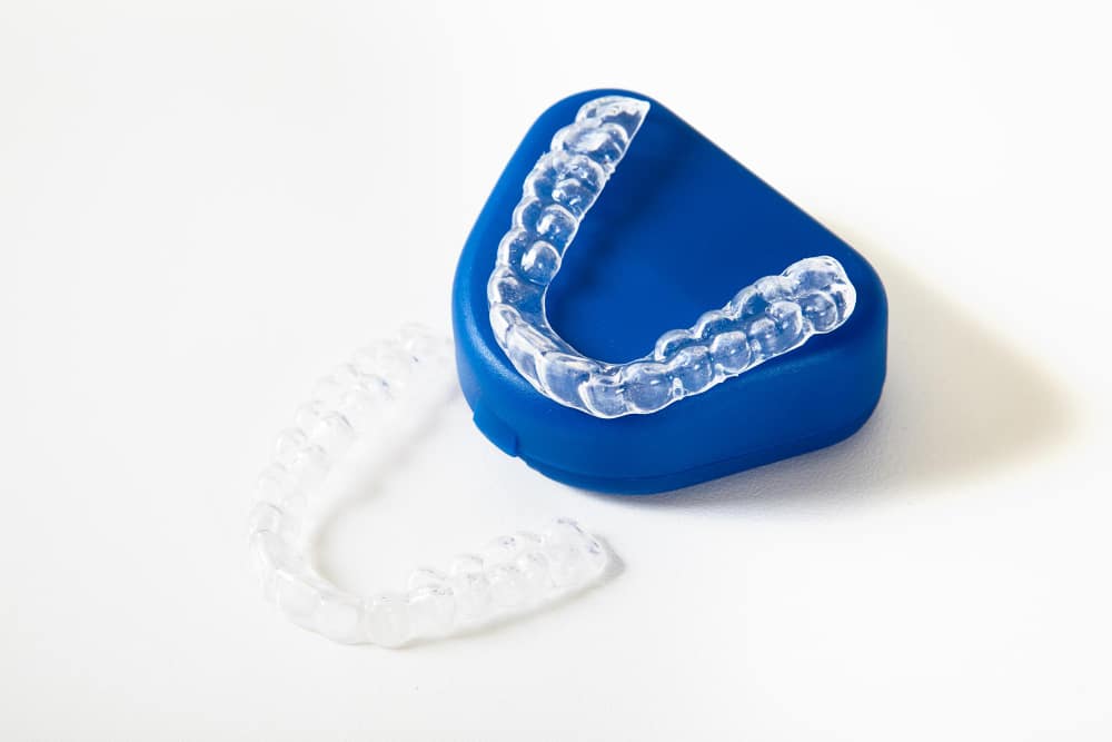 5 Reasons to Consider Aligners to Straighten Your Teeth