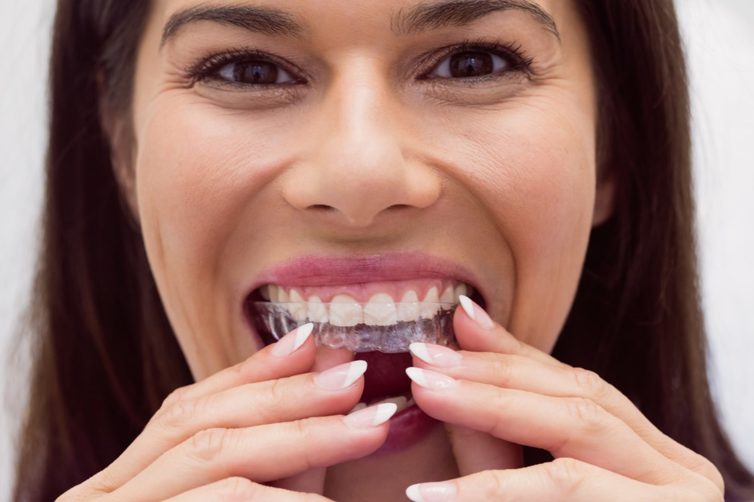CandidPro Orthodontics In Mundelein