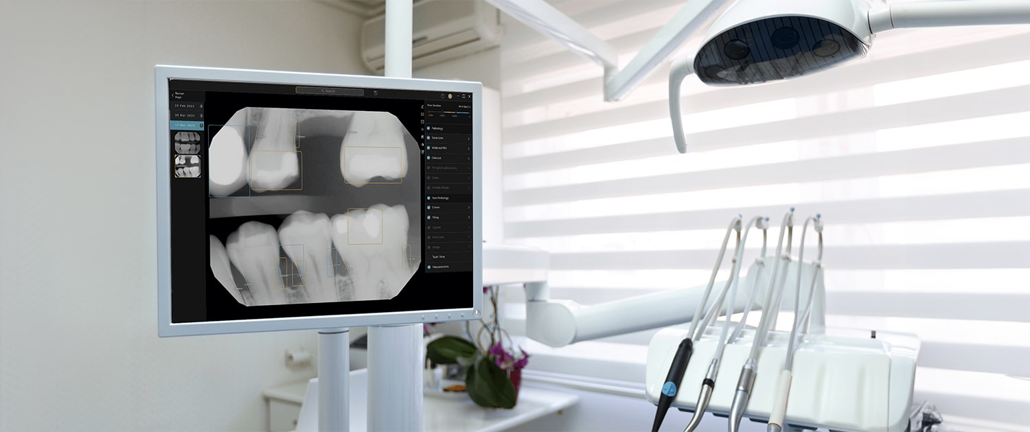 Smarter Smiles: How Pearl AI Radiographic Interpretation Enhances Your Dental Care