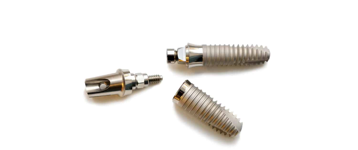What Are Dental Implants Made Of?